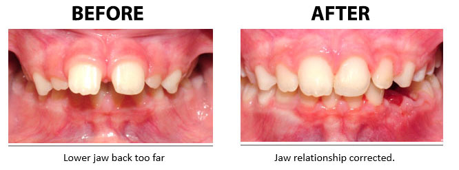 Before and after example 1