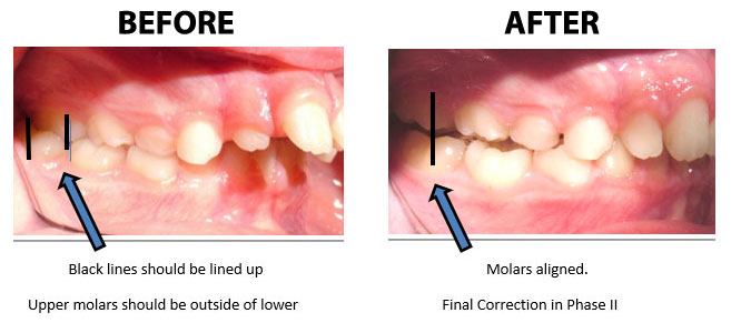 Before and after example 2