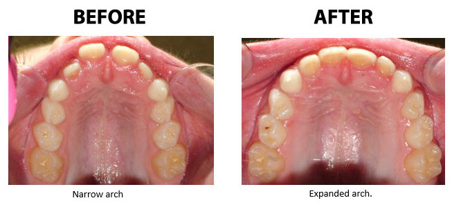 Before and after example 3